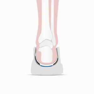 CoreStep выравнивает стопу