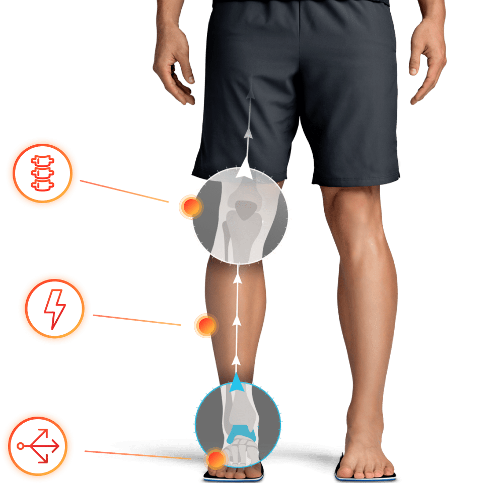 Ортопедические стельки CoreStep — здоровая осанка