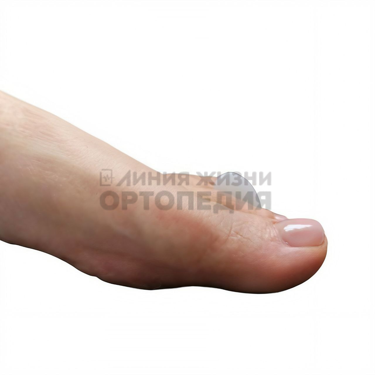 [14 С] Корригирующая прокладка