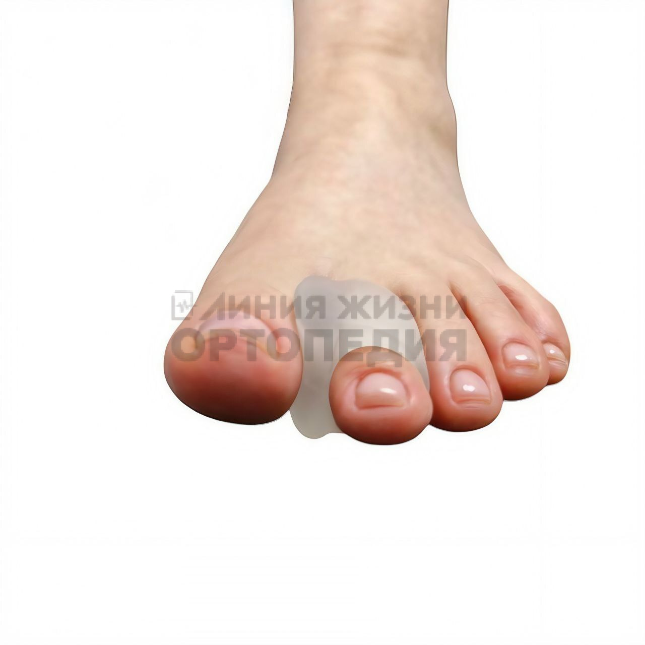 [204С],Разделитель межпальцевый с кольцом на палец