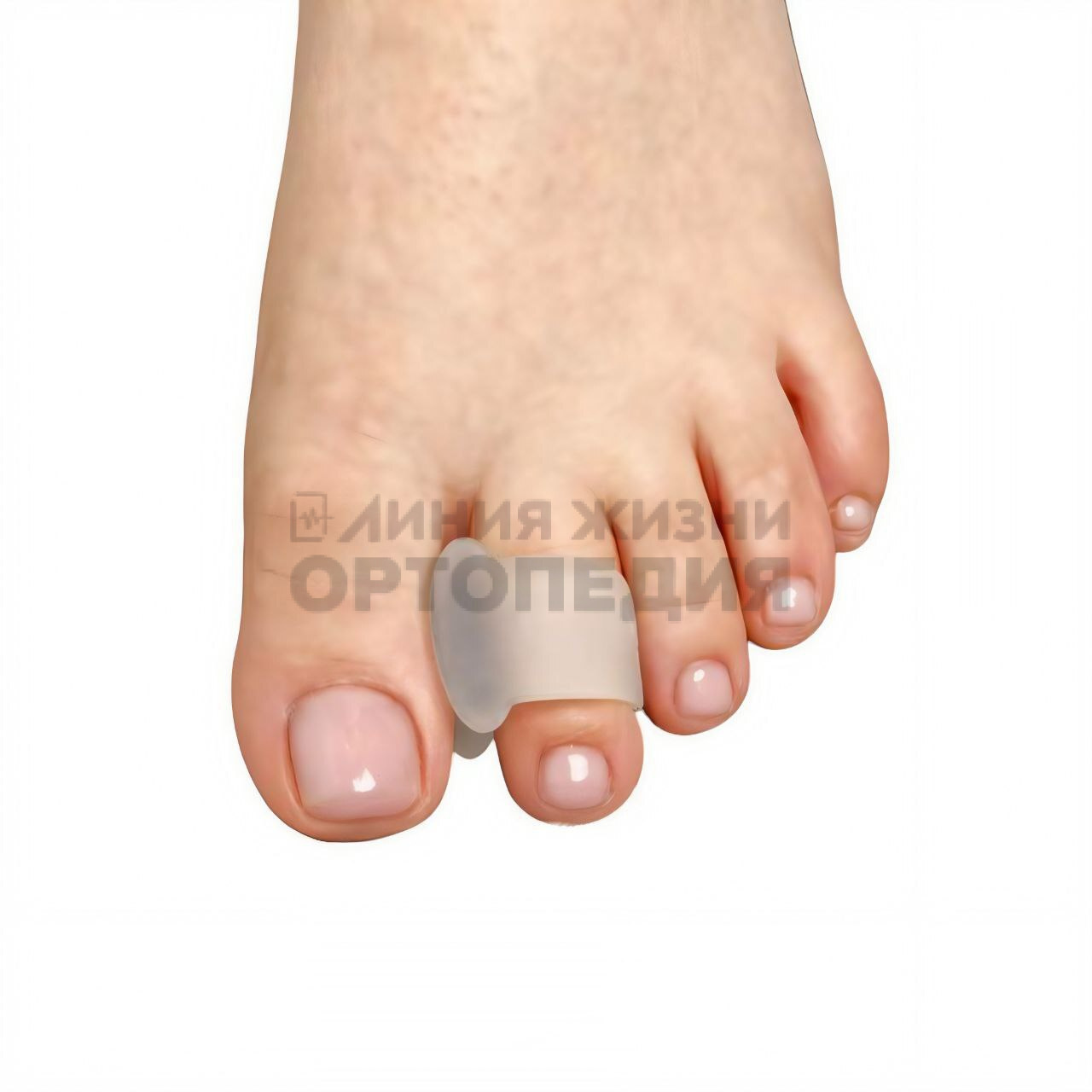 [204С],Разделитель межпальцевый с кольцом на палец