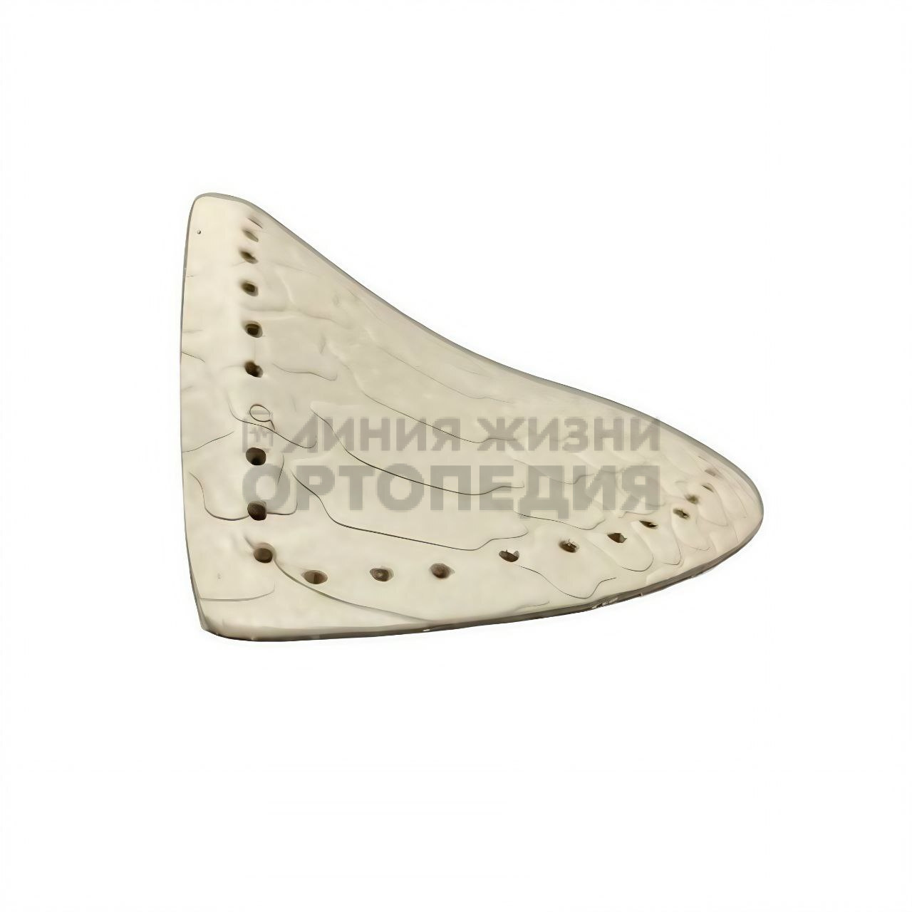 [28 К] Пелот продольного свода